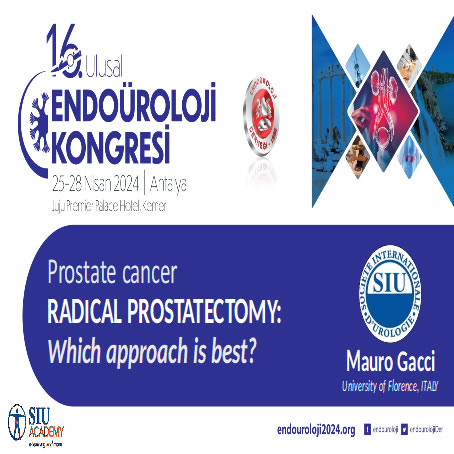 Il miglior approccio alla prostatectomia radicale